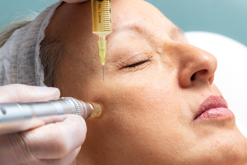 Plasma Fibroblast Skin Tightening Treatment