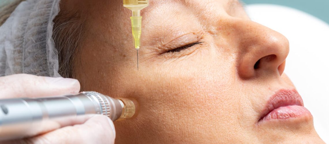Plasma Fibroblast Skin Tightening Treatment
